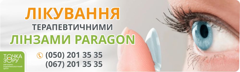 Лікування терапевтичними лінзами PARAGON. «ТОЧКА ЗОРУ» м. Коломия